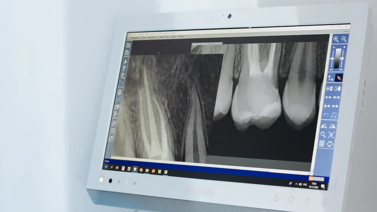 Understanding X-ray Inspection Technology
